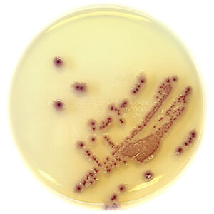 Ready to Use Agar 90mm & 140mm Plates
